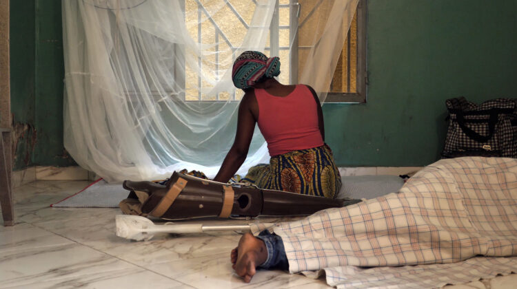 Still uit de film Downstream to Kinshasa. Een vrouw zit voor het raam met haar prothese in beeld